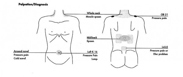 adrenal diagram
